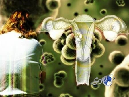 متلازمة الأيض تزيد الإصابة بسرطان الرحم