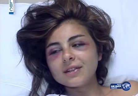 بالفيديو: رجل يشوه وجه زوجته وحرقها بسبب الغيرة