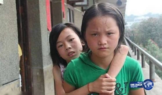 طفلة تحمل صديقتها المعاقة على ظهرها 4 أميال يوميًّا للمدرسة لمدة 3 سنوات