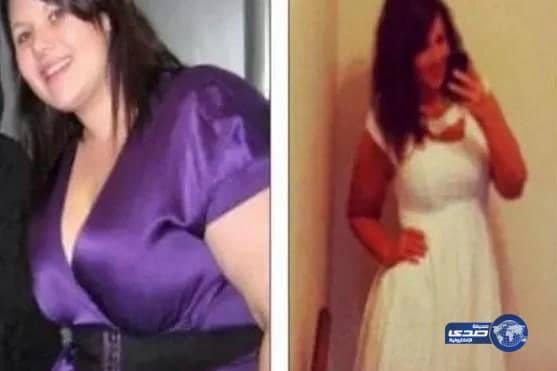 امرأة تخسر 60 كلغ من وزنها بمساعدة إنستغرام