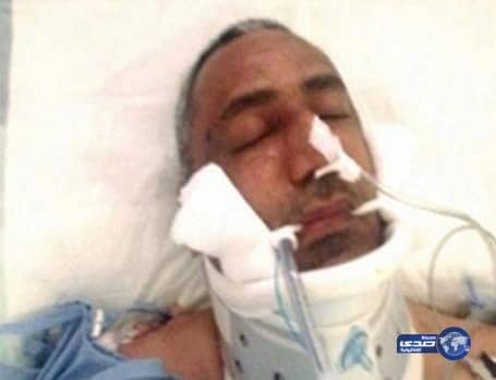 ارتفاع عدد ضحايا "تفجير القديح" إلى 22 شهيداً بوفاة "آل فتيل"