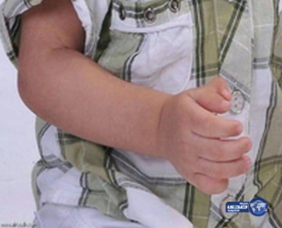 القطيف: عائلة تشكو طبيباً بتر إصبع طفلها بالخطأ