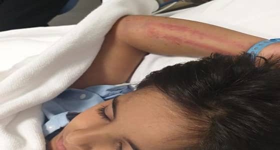 سقوط طفل من سطح عمارة سكنية بارتفاع 16 مترًا بالجبيل