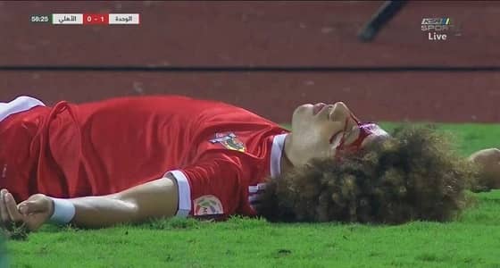 الفحوصات الطبية توضح إصابة علي النمر