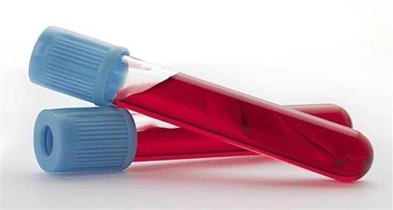 دراسة دنماركية تكتشف علاج جديد لفيروس الإيبولا