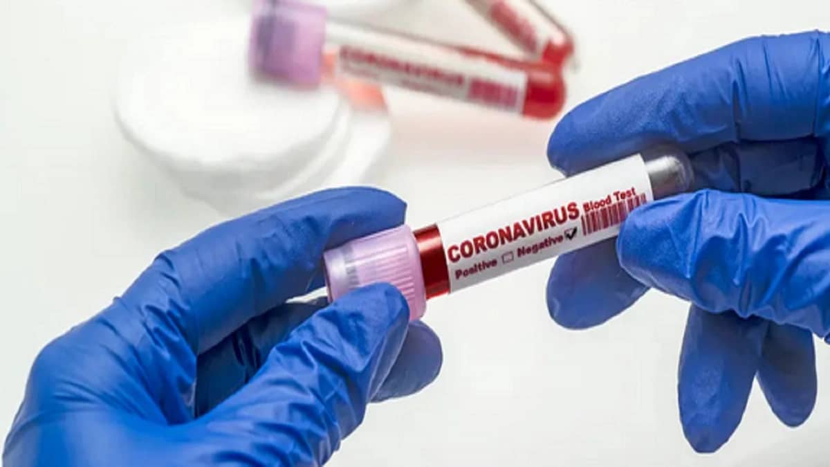 ارتفاع نسبة المتعافين من كورونا في المدينة المنورة