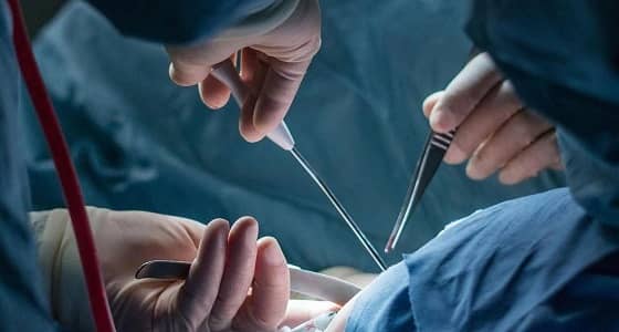 8 حالات يتم اللجوء فيها للولادة القيصرية