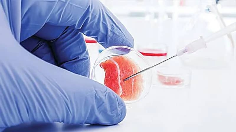 «الصحة»: لم يثبت علميًا أي علاقة بين الخلايا الجذعية والشفاء من مرض السكري