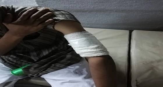 بالصور.. تفاصيل اقتحام مواطن للنيران لإنقاذ أبناء جارته من حريق