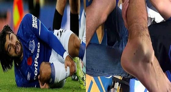 صورة متداولة مرعبة لإصابة أندريه جوميز