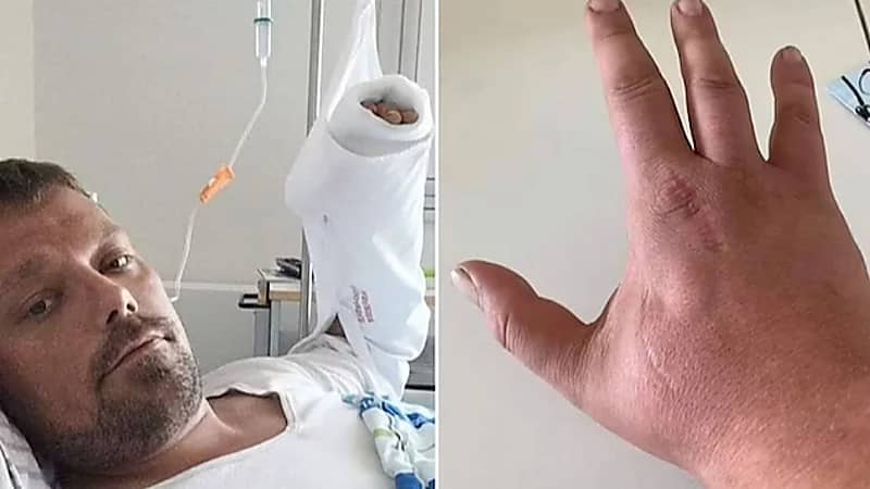 بعد سنوات من الحادثة.. عضة قطة تنهي حياة شاب