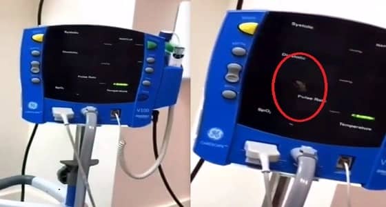 بالفيديو..صرصور على جهاز ضغط بأحد مستشفيات القنفذة