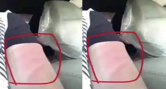 سائق سعودي يروي قصة اعتداء فتاة بالضرب عليه.. والمغردون لا يصدقونه