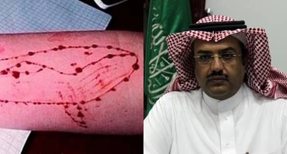 بعد انتحار طفل أبها.. " النمر " يوجه رسالة للأهالي