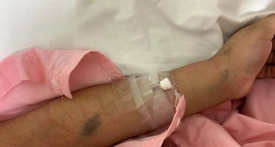 إصابة طالبة ابتدائي بالطائف بـ أنفلونزا الخنازير