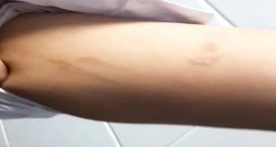 تفاصيل جديدة حول الطفلة المُعذبة على يد زوجة أبيها