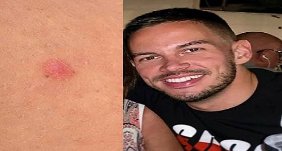 تطبيق ينقذ شابا مصابا بالسرطان من الموت